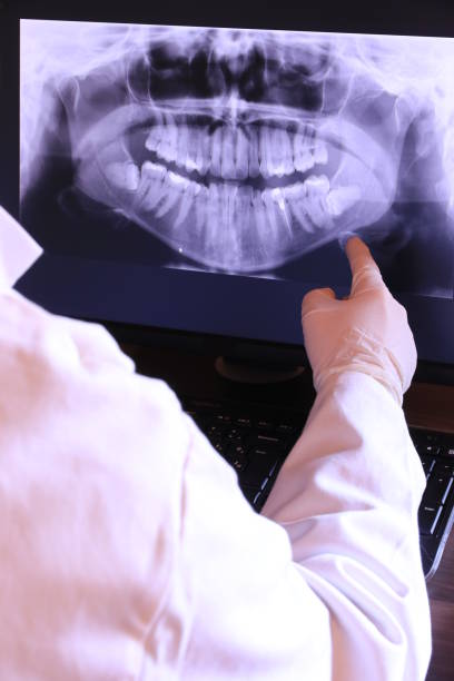 Best Emergency Tooth Extraction in High Rolls, NM